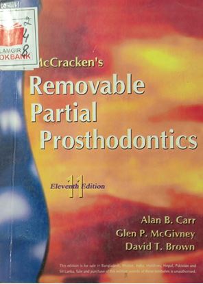 Picture of Removable Partial Prosthodontics